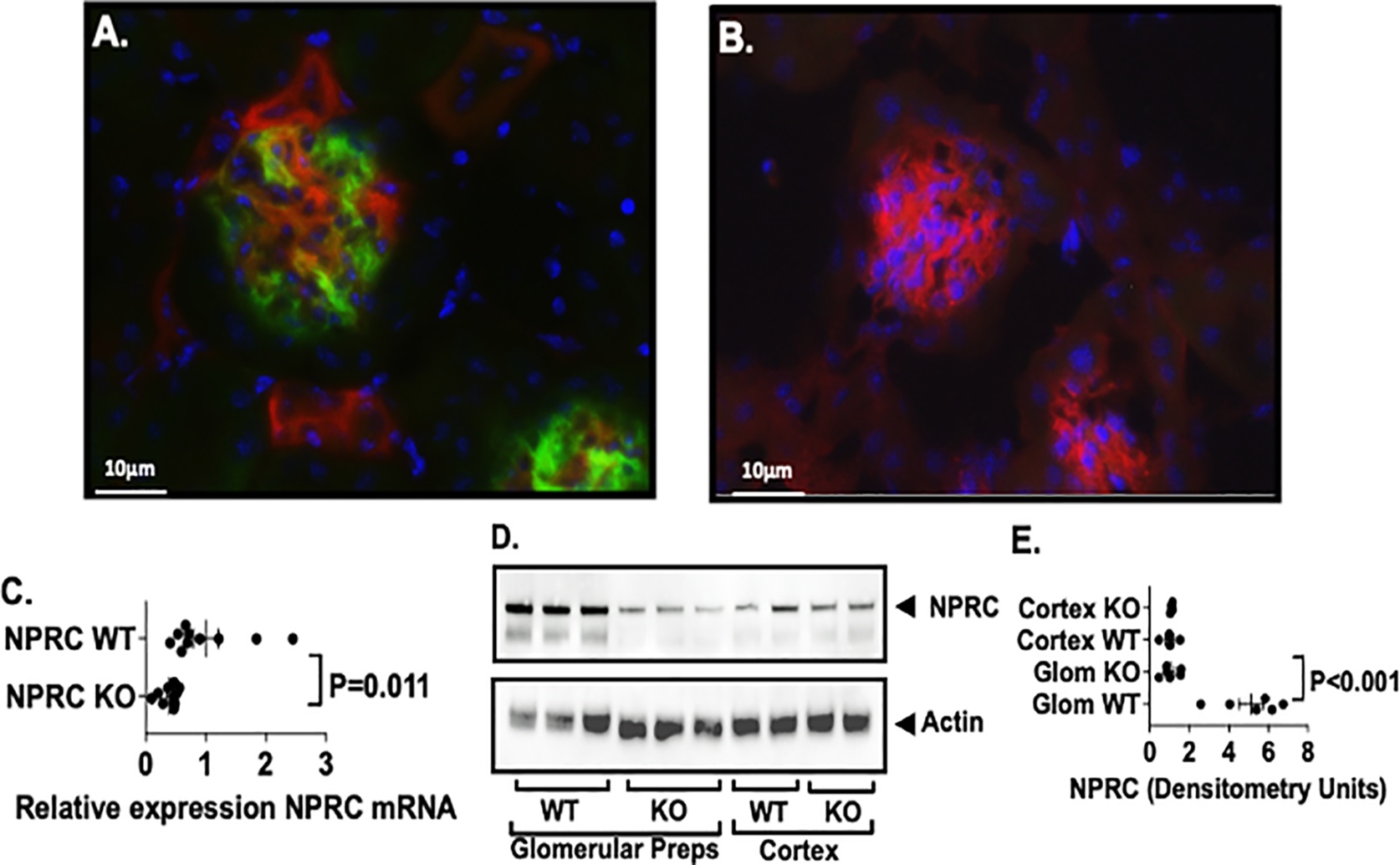 Blocking a Kidney Receptor Protects Against Kidney Disease