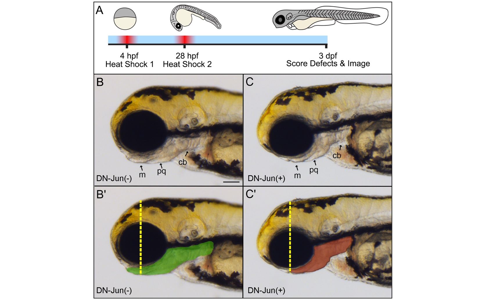 Jun Protein Needed for Optic Nerve Regrowth in Young Fish