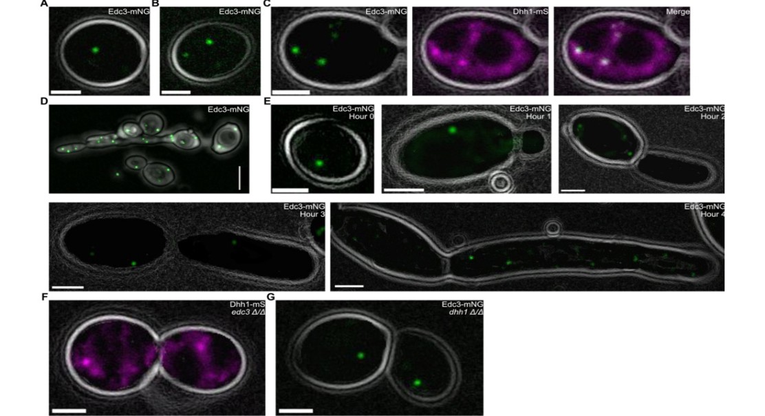 How Cell Machinery Helps Yeast Shape Change and Handle Stress