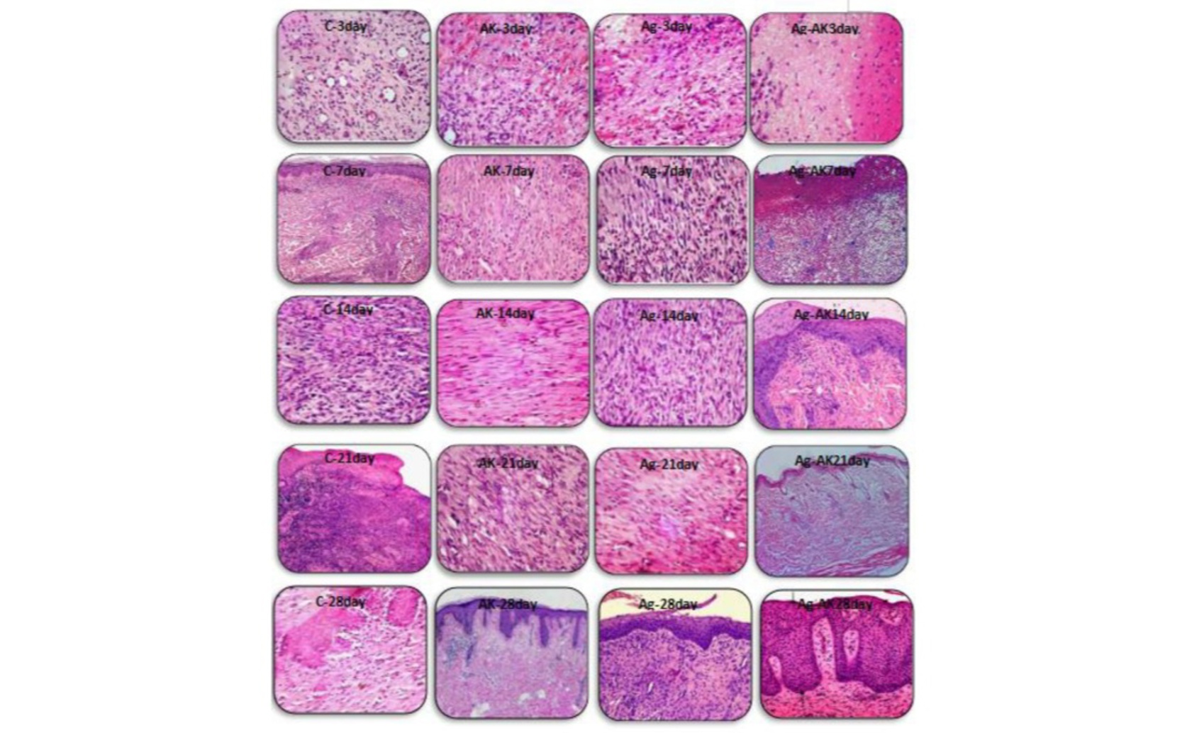 Silver Nanoparticles Improve Healing of Infected Wounds
