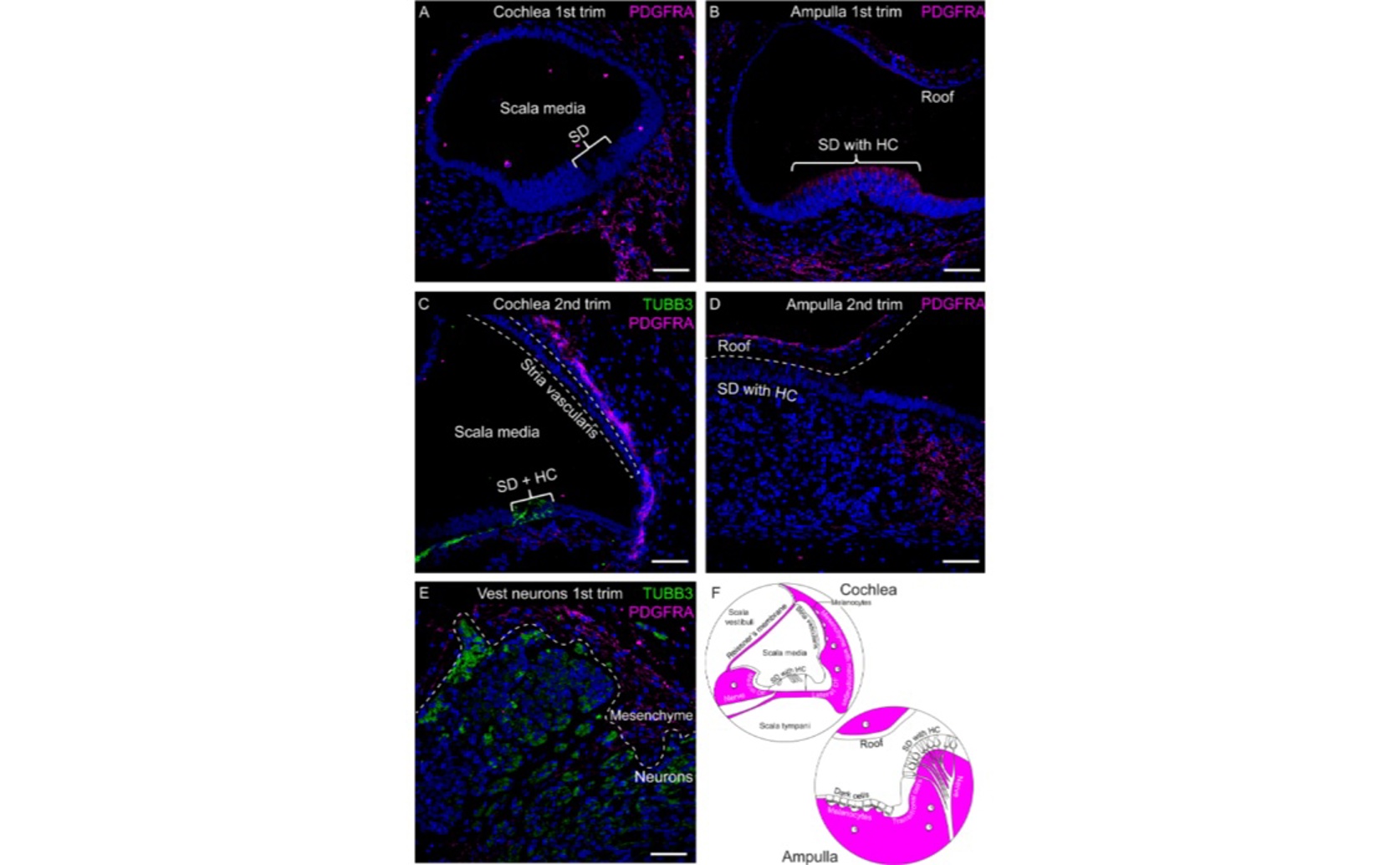 Impact of a Common Virus on a Baby's Inner Ear