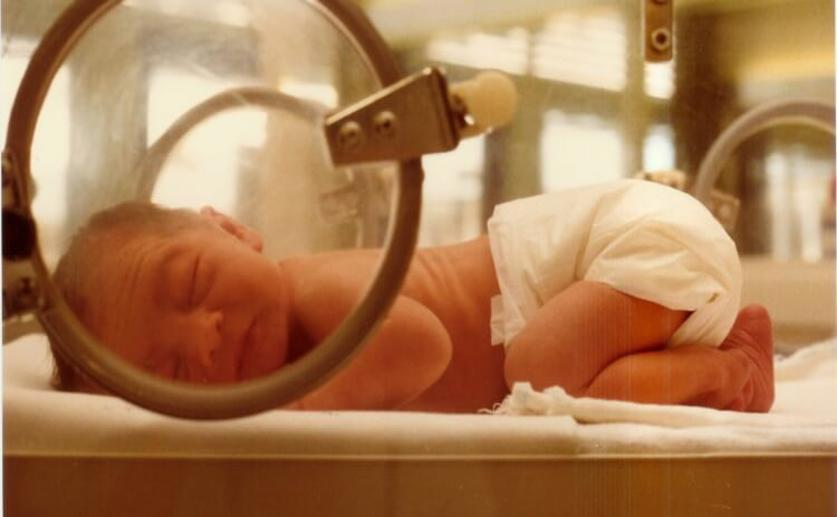 Developmental Problems in Premature Babies Begin Before Birth