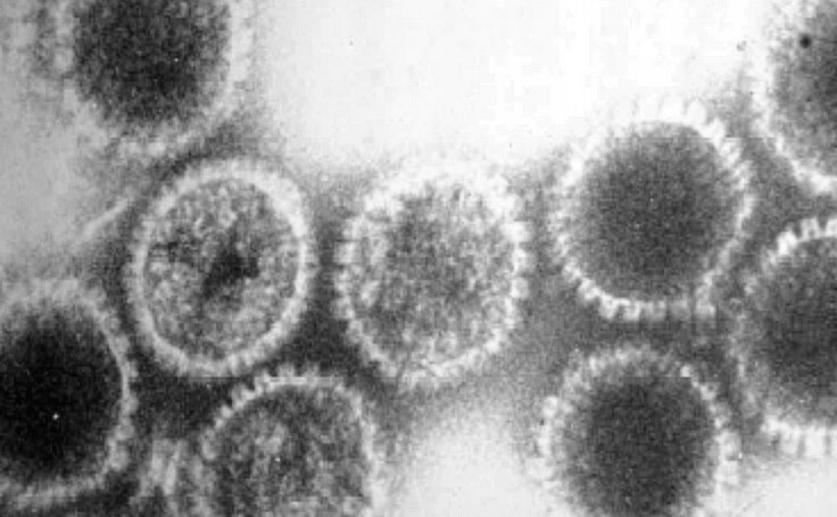 New Findings May Lead to Improved Treatments for Herpesvirus