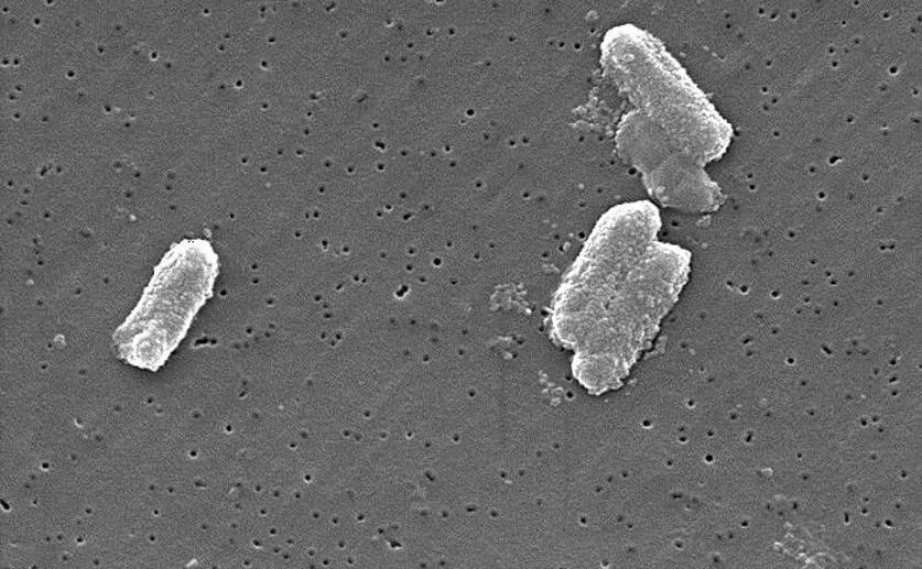 Researchers Discover a Clever Strategy That Allows Enteric Pathogens to Survive in Anaerobic Environments