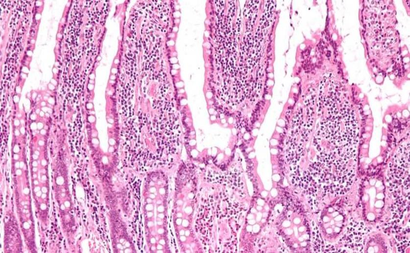 Researchers Grow Fully Functional Human Intestinal Tissue in Laboratory