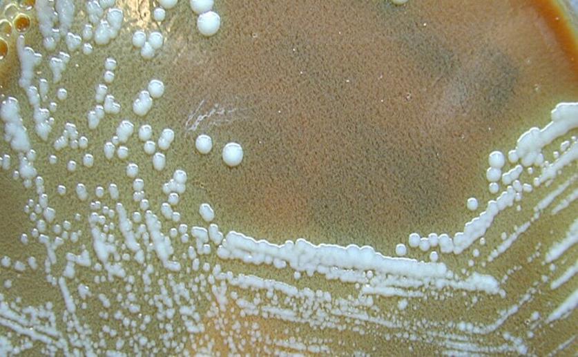 Researchers Use Genomic Analysis to Study the Deadly Bacteria Responsible for “Rabbit Fever”