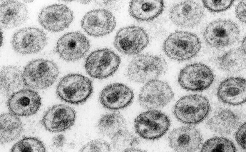 Retroviruses, a Family That Includes HIV, Evolved During the Early Paleozoic Era