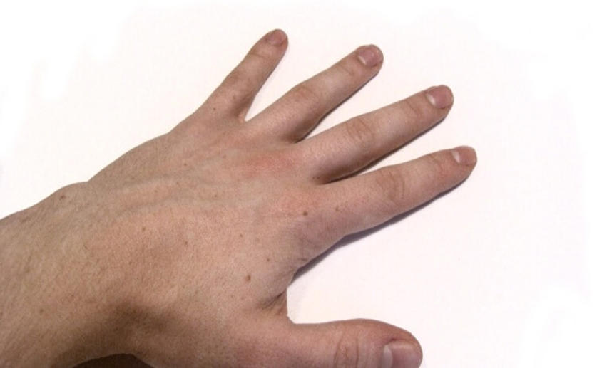 Scientists Discover Genetic Mechanisms That Lead to Five-fingered Hands
